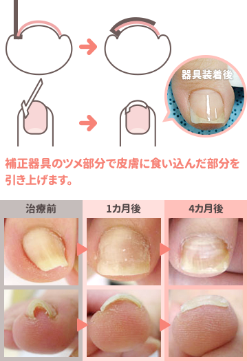 ペディグラス