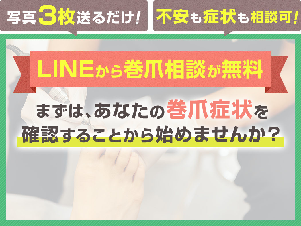 LINEから巻爪相談が無料